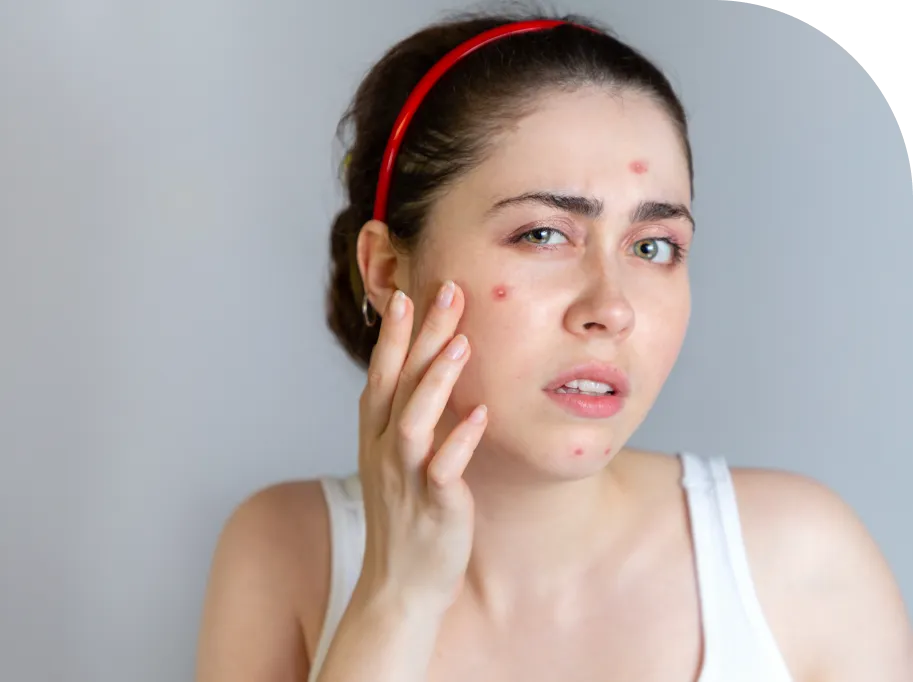 Acne Treatment at Maya Skin & Brow Studio, Midtown Manhattan