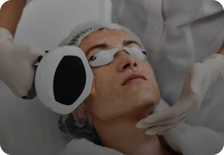 Rajeunissement de la peau par IPL chez Maya Skin & Brow Studio, Midtown Manhattan