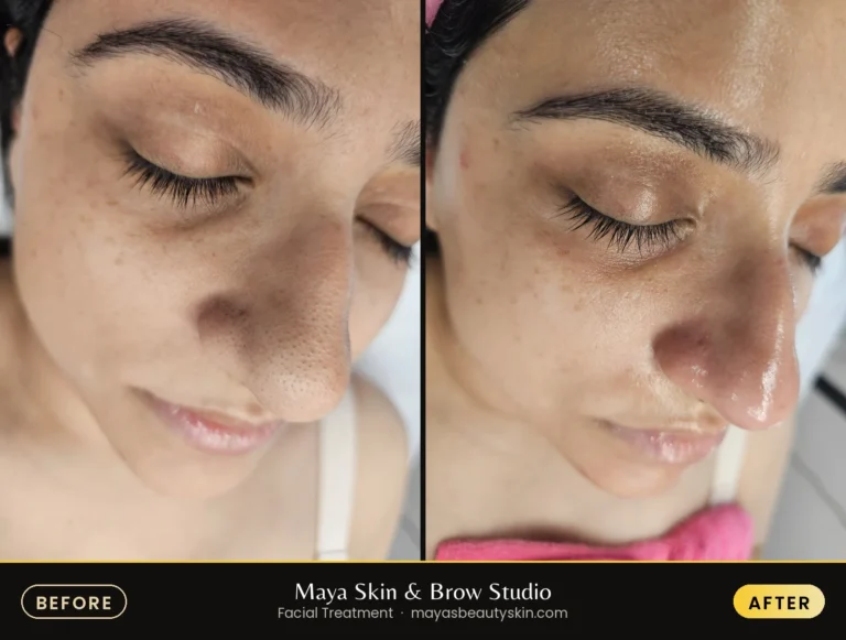 Signature Facial before and after, real client at Maya Skin & Brow Studio, Midtown Manhattan